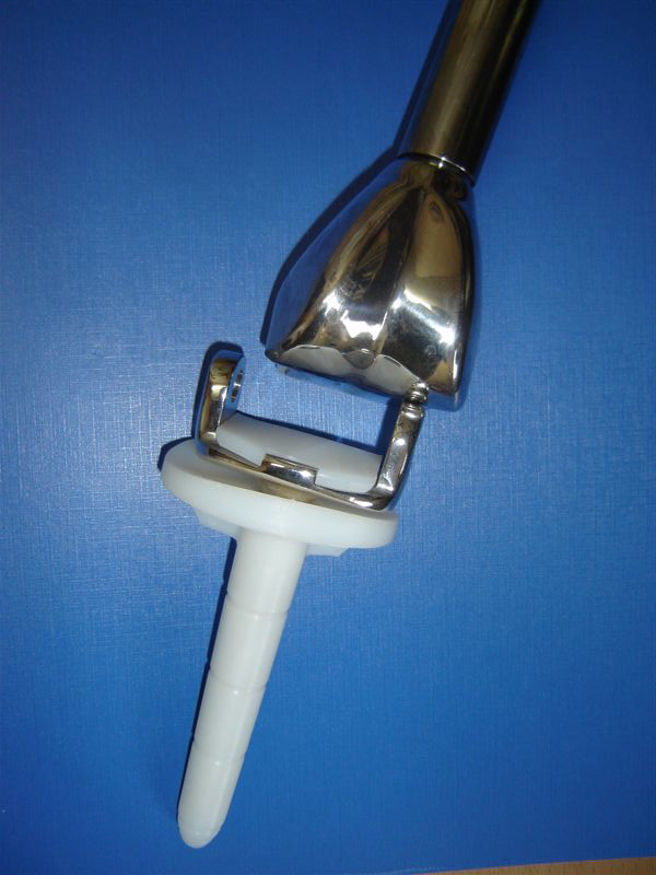 Explanted distal femur